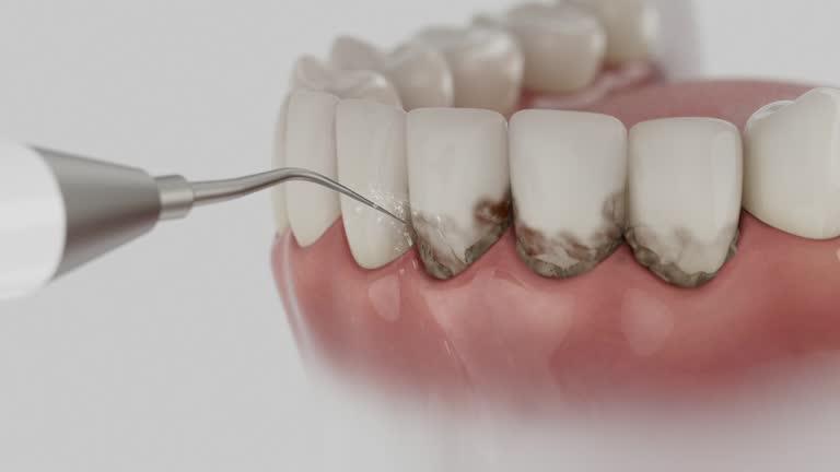 Trusted Emergency Dentist service in Sherwood, OR - Dentist Open Now